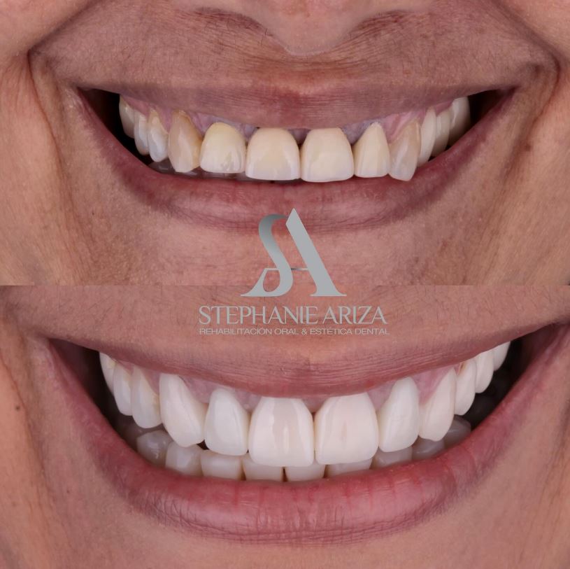 Estética Dental